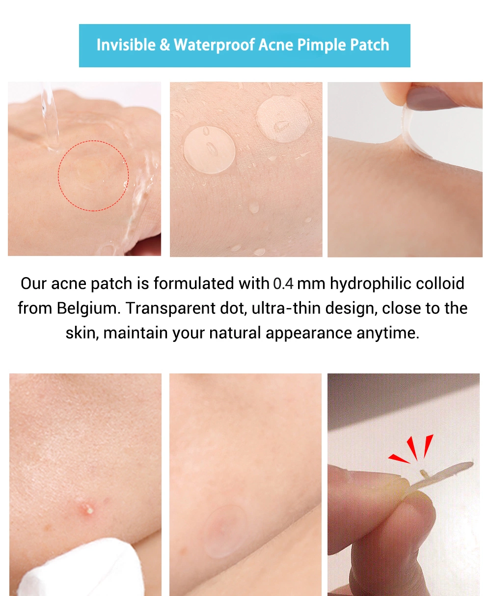 OEM Butterfly Shape Pimple Remove Patch Hydrocolloid Acne Absorbing Cover Patch 20dots/Patch