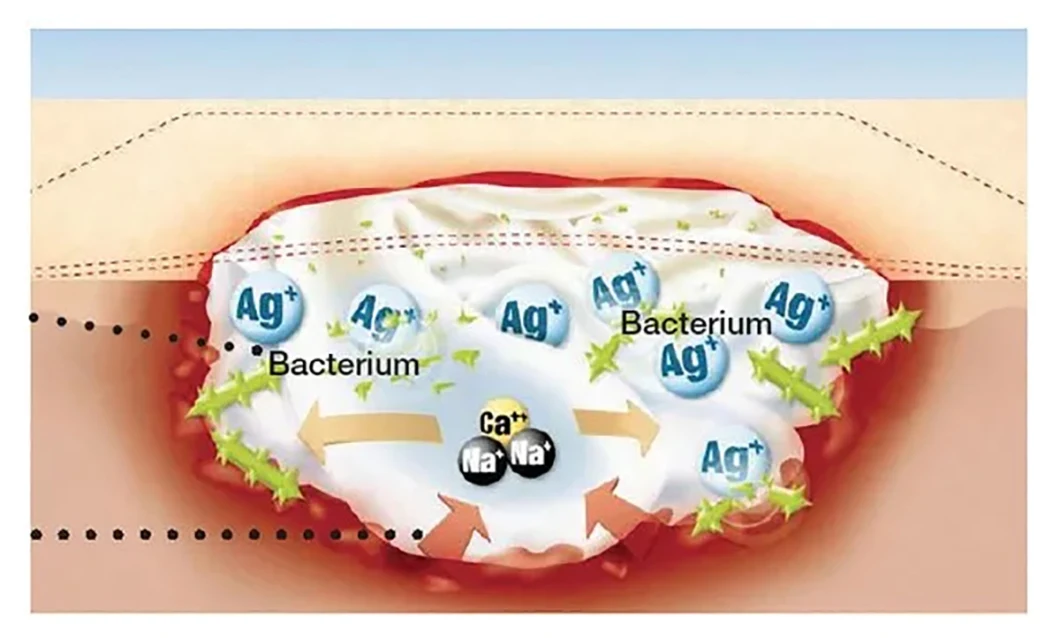 AG Ion Silver Calcium Alginate Dressing for Hyperexuding Wounds Absorb